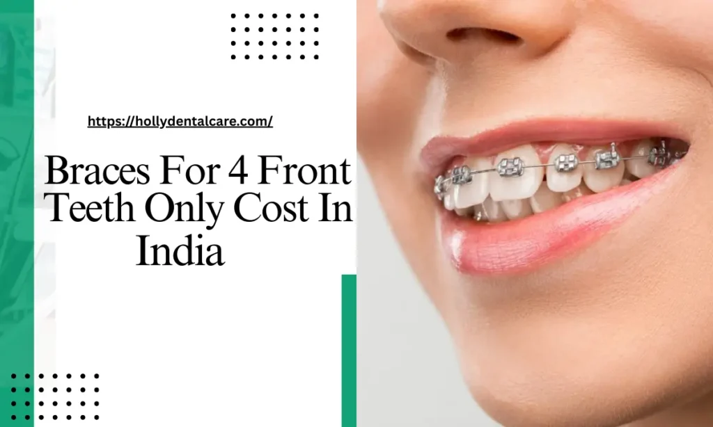 Braces for 4 Front Teeth Only Cost in India
