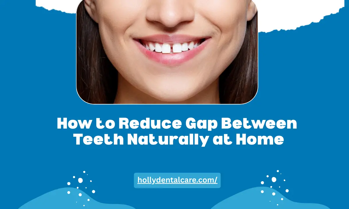 How to Reduce Gap Between Teeth Naturally at Home
