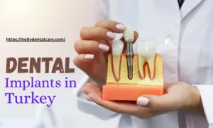 Dental Implants in Turkey