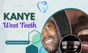 Kanye West Teeth