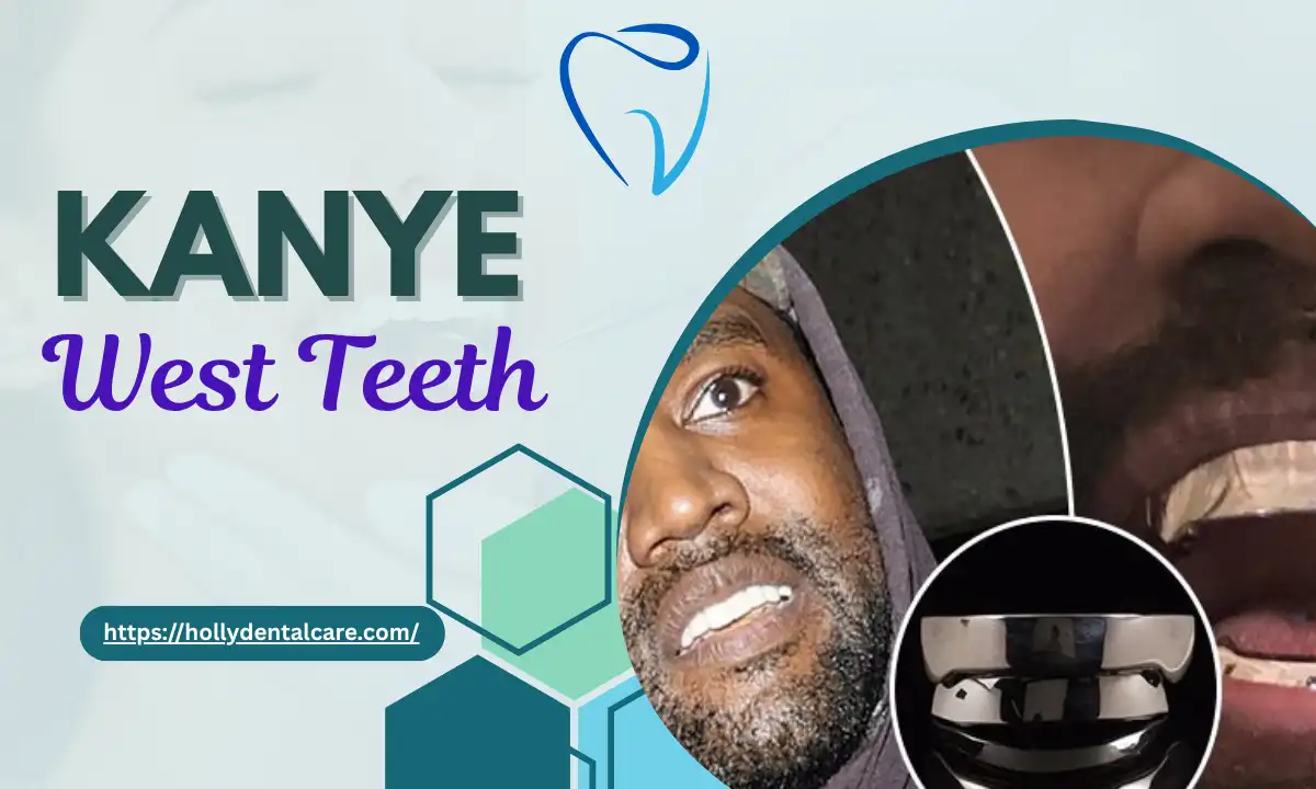 Kanye West Teeth