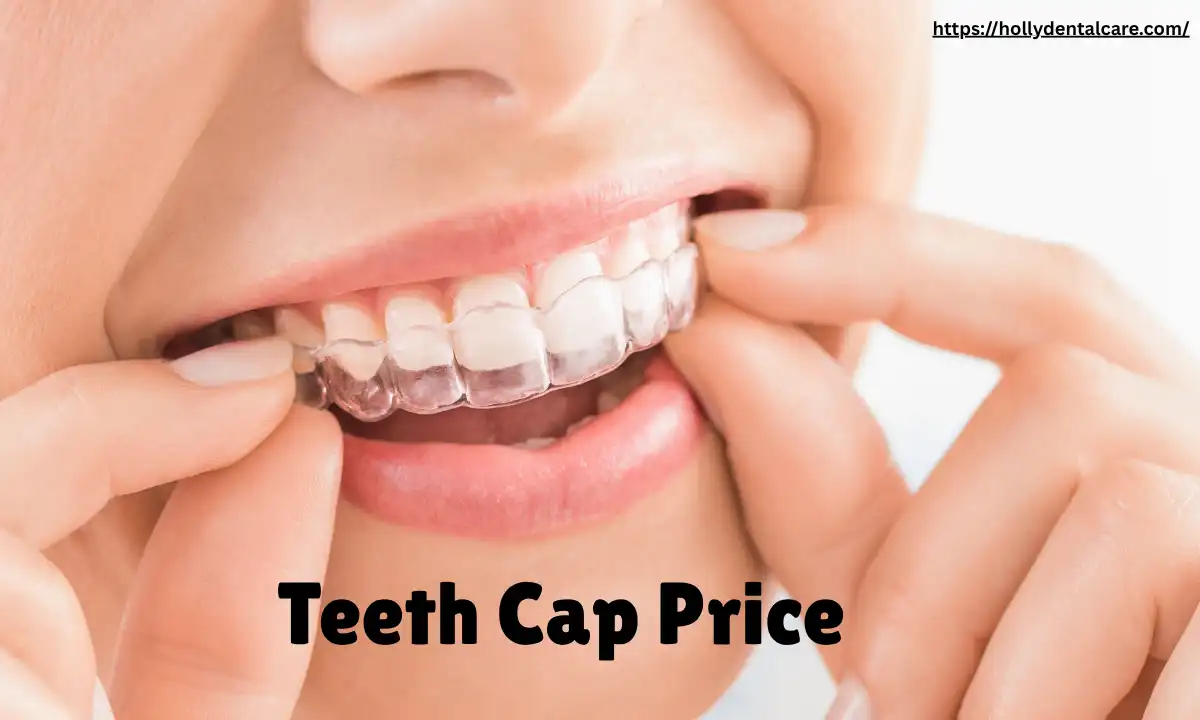 Teeth Cap Price