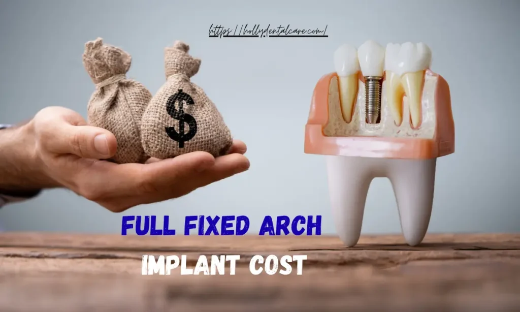 Full Fixed Arch Implant Cost
