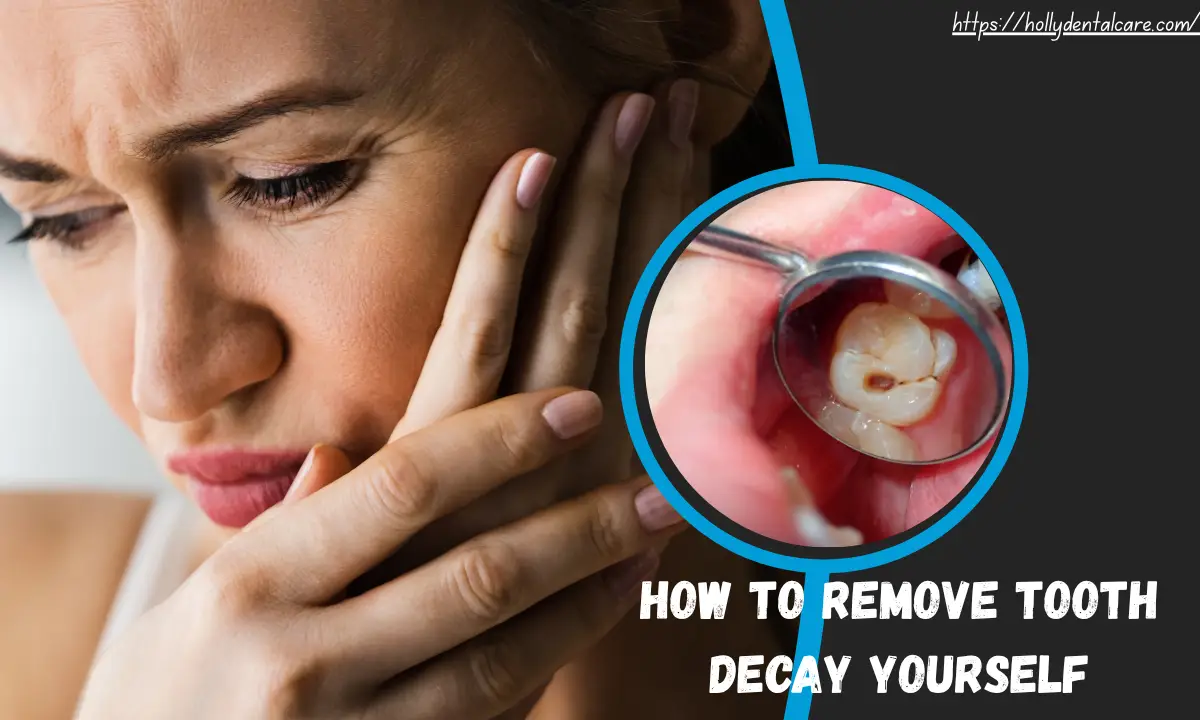 How to Remove Tooth Decay Yourself