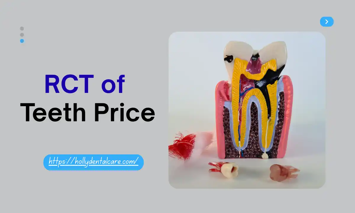 RCT of Teeth Price
