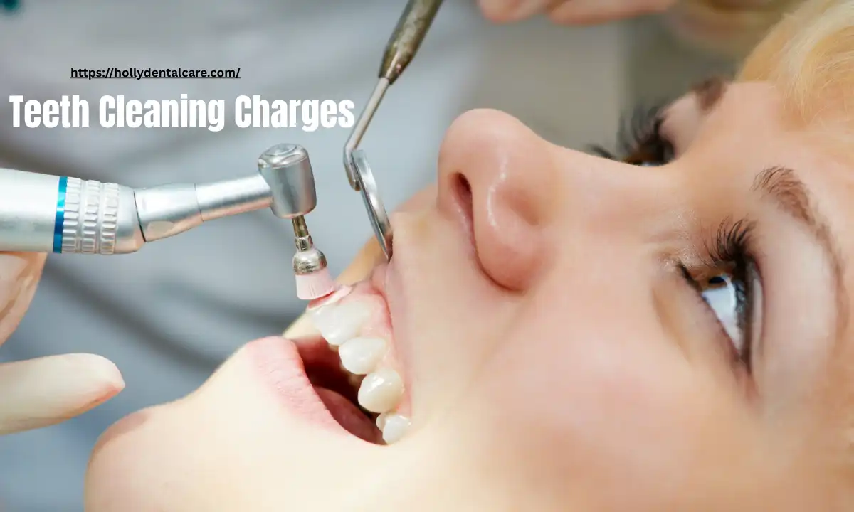 Teeth Cleaning Charges