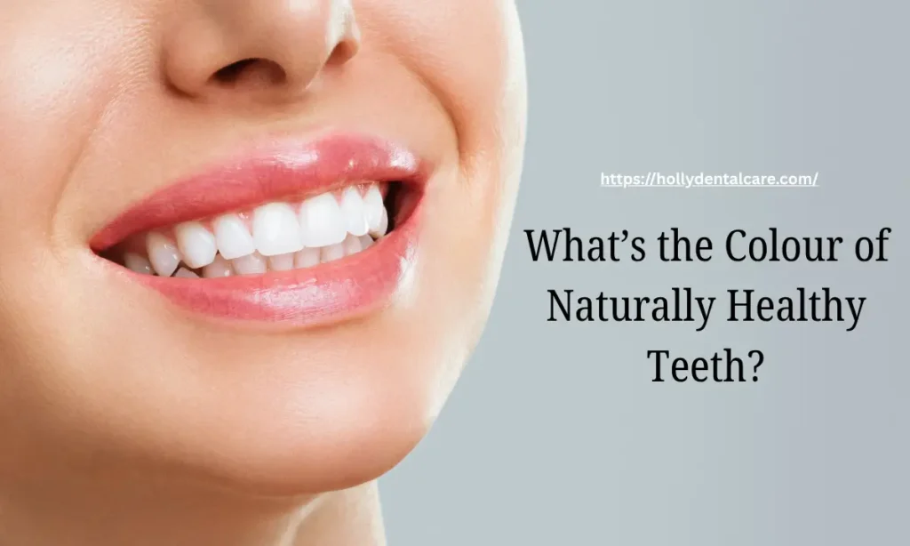 What’s the Colour of Naturally Healthy Teeth?