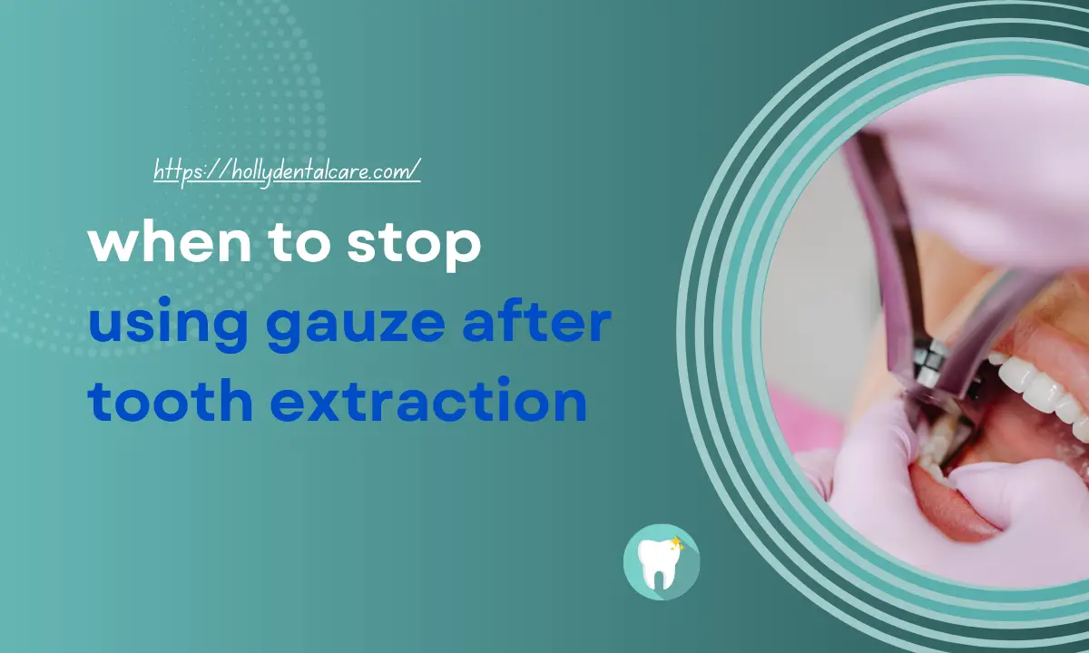 When to Stop Using Gauze After Tooth Extraction