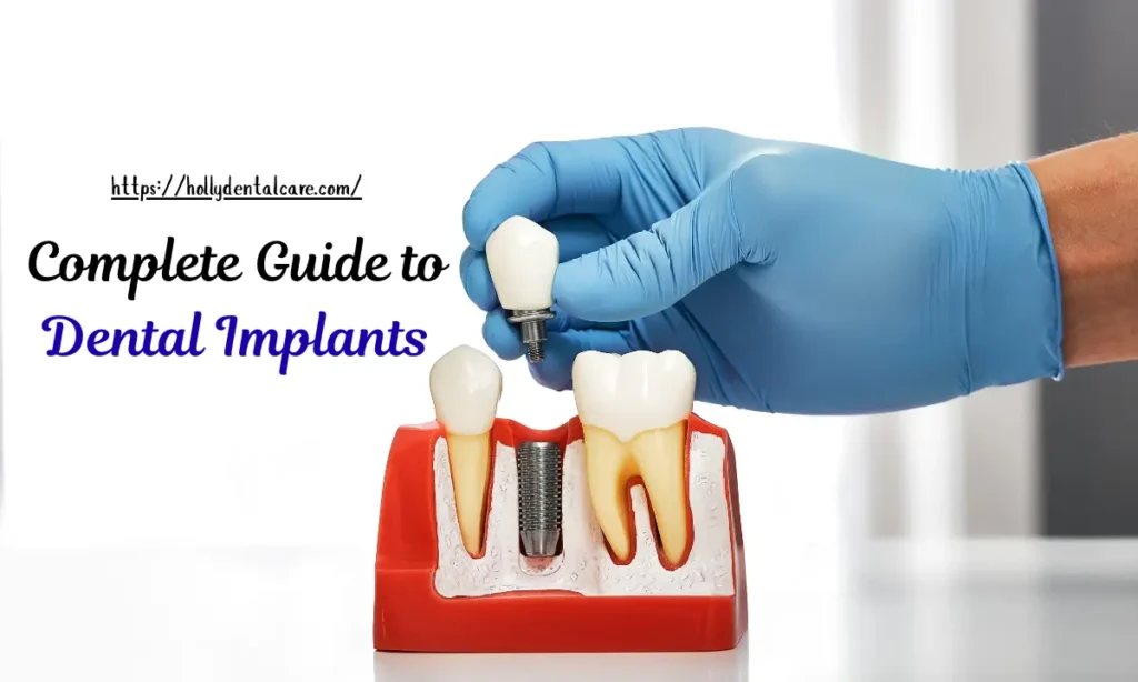 Complete Guide to Dental Implants