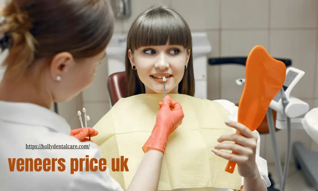 Veneers Price UK