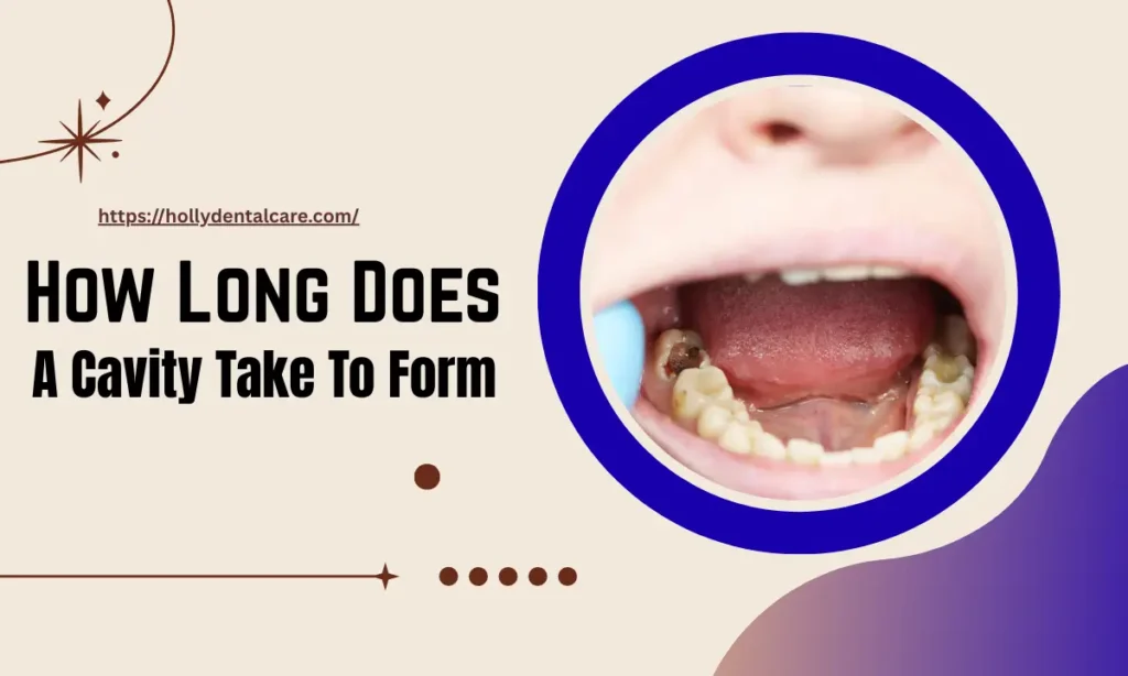How Long Does a Cavity Take to Form