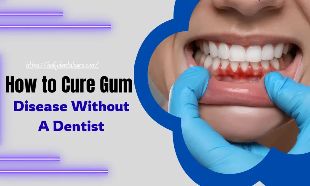 How to Cure Gum Disease Without a Dentist