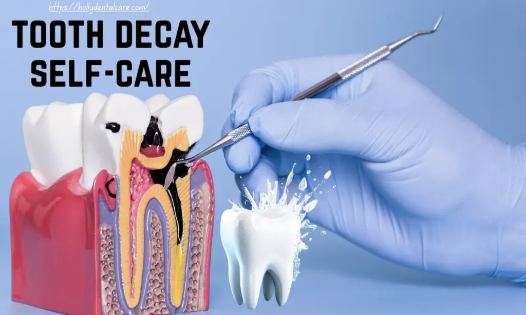 Tooth Decay Self-Care