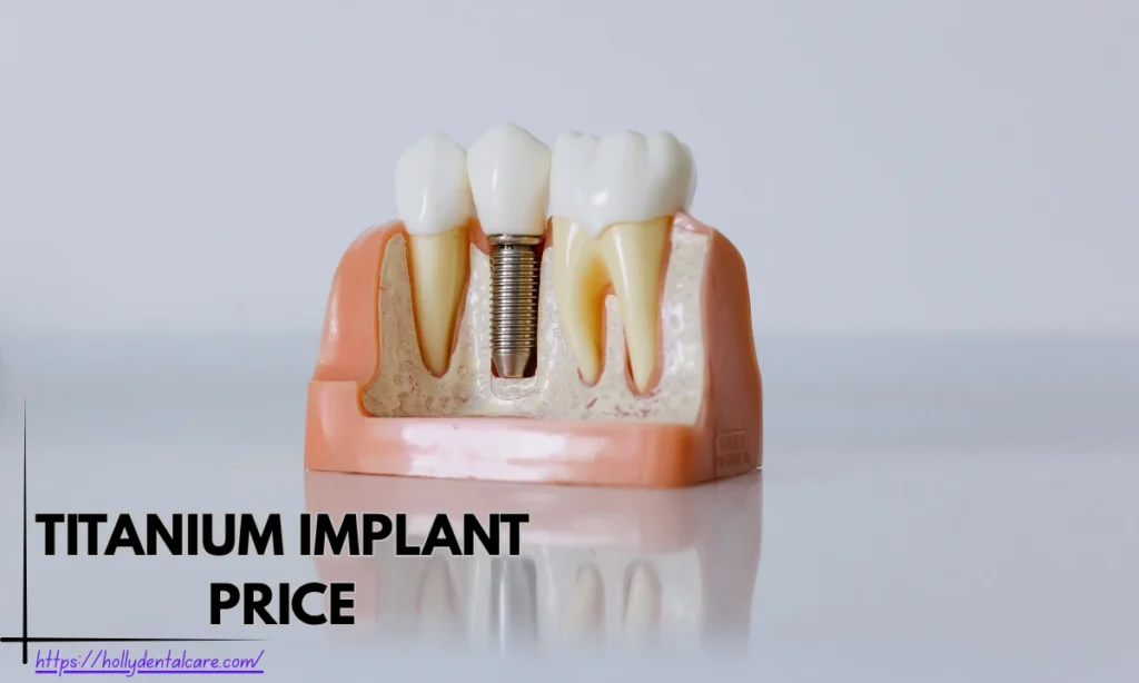 Titanium Implant Price