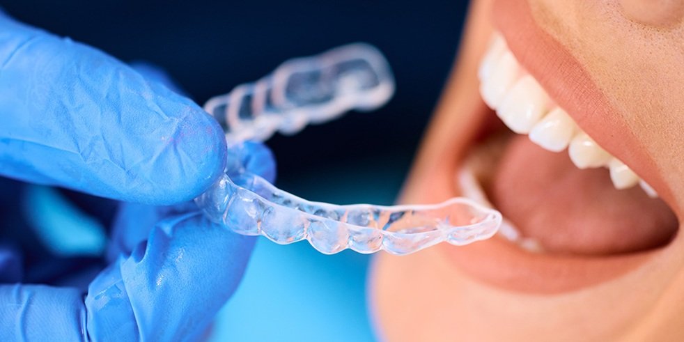 What To Expect During Invisalign Middlesbrough Treatment Journey Step By Step