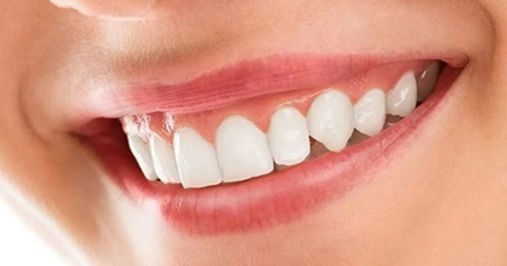 Cosmetic Smile Makeover Cost in Auckland: What You Need to Know Before You Start
